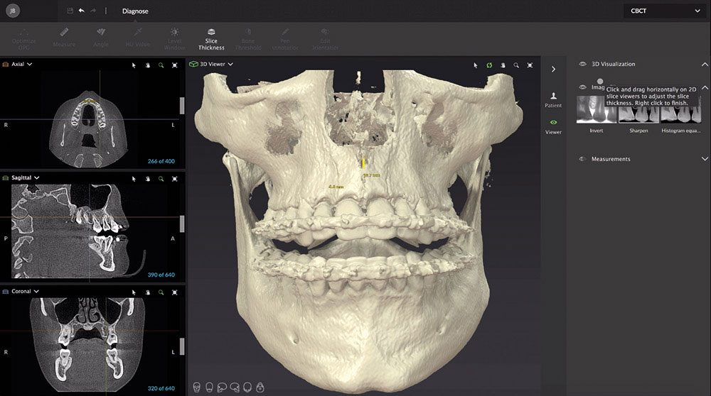 「歯科用CT」による分析