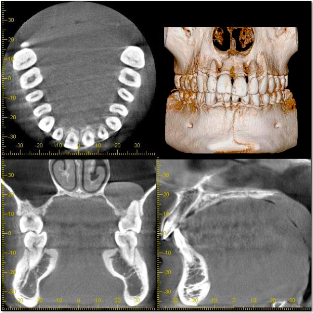 「歯科用CT」で噛み合わせや顎の状態を詳しく診断していきます