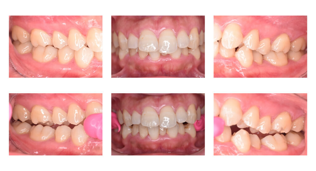 1 1 矯正歯科の窓口|佐世保：歯の矯正で後悔しないための最後のチェックポイント