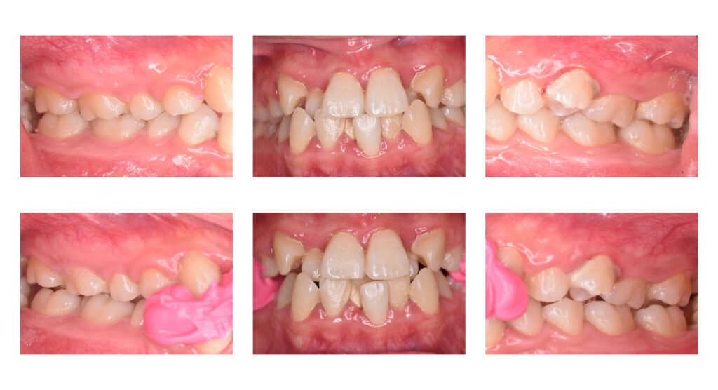 10 矯正歯科の窓口|佐世保：歯の矯正で後悔しないための最後のチェックポイント