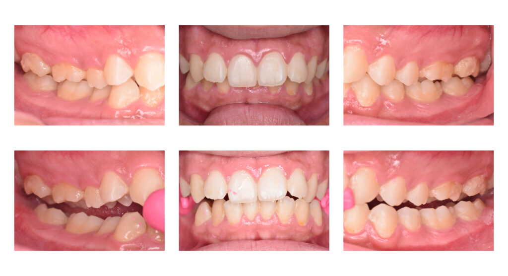 4 矯正歯科の窓口|佐世保：歯の矯正で後悔しないための最後のチェックポイント