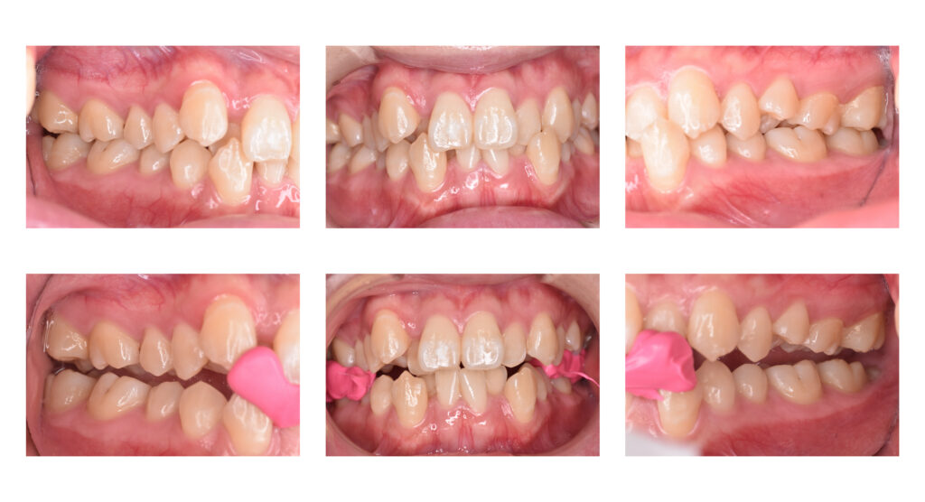 5 矯正歯科の窓口|佐世保：歯の矯正で後悔しないための最後のチェックポイント