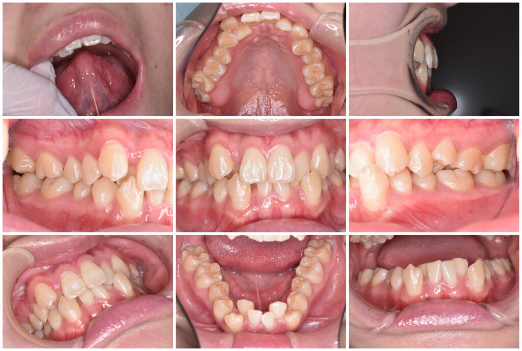 6 矯正歯科の窓口|佐世保：歯の矯正で後悔しないための最後のチェックポイント