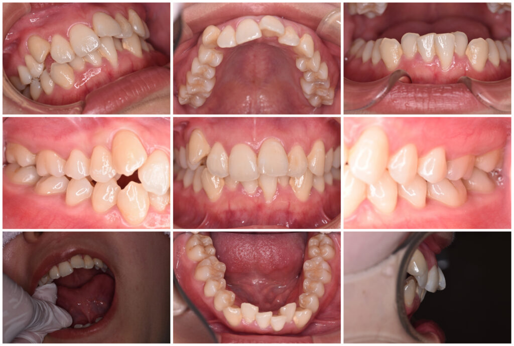 7 矯正歯科の窓口|佐世保：歯の矯正で後悔しないための最後のチェックポイント