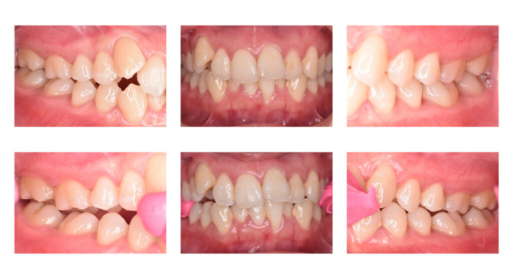 8 矯正歯科の窓口|佐世保：歯の矯正で後悔しないための最後のチェックポイント