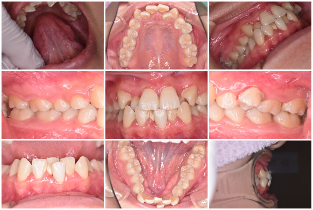 9 矯正歯科の窓口|佐世保：歯の矯正で後悔しないための最後のチェックポイント