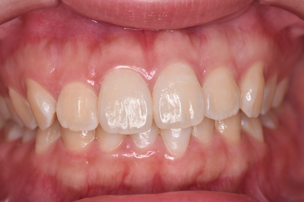 歯科矯正の窓口